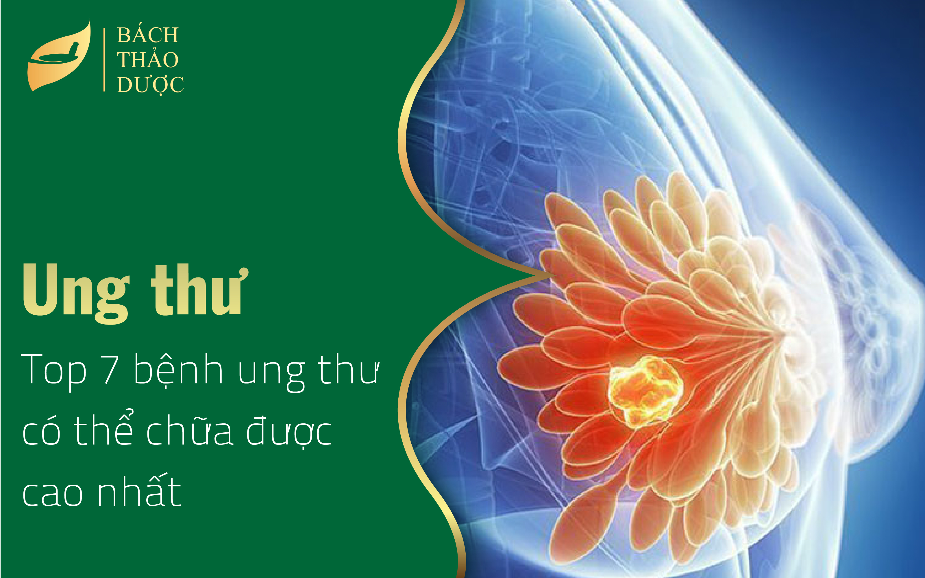 Top 7 bệnh ung thư có thể chữa được cao nhất dựa trên tỷ lệ sống sót sau 5 năm