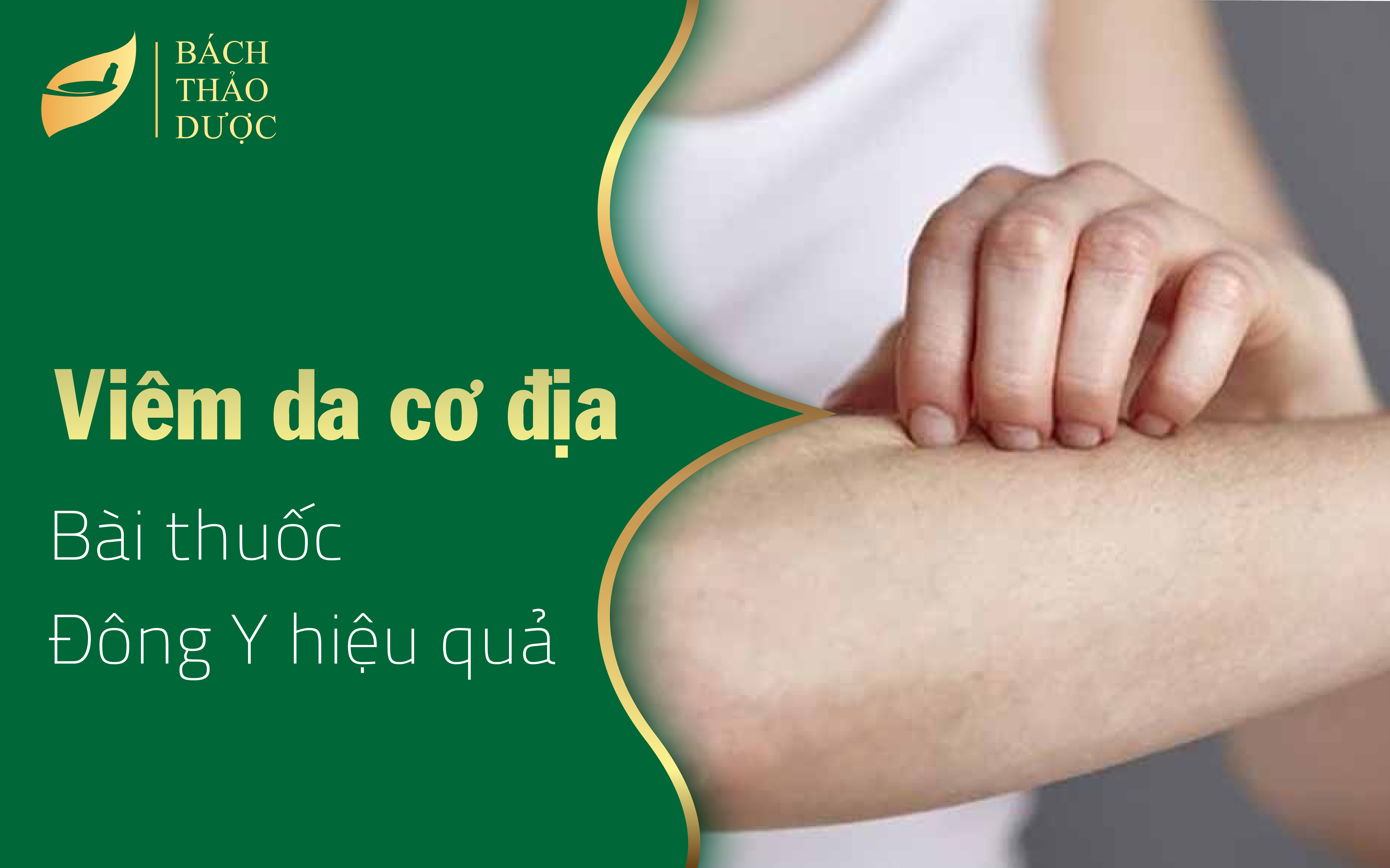 Bài thuốc Đông y chữa viêm da cơ địa