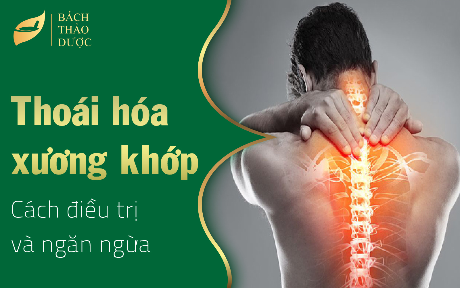 10 cách điều trị và ngăn ngừa thoái hóa khớp hiệu quả, khoa học